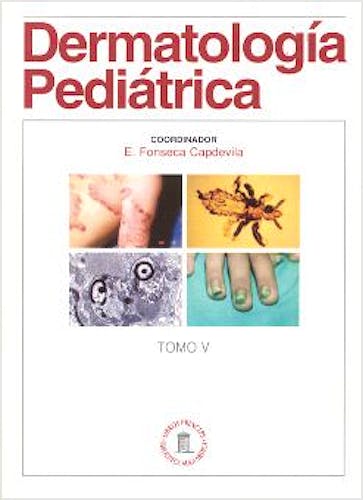 Portada del libro 9788478853298 Dermatología Pediátrica, Tomo V