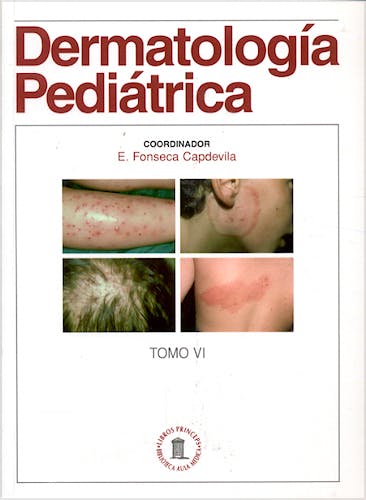 Portada del libro 9788478853939 Dermatología Pediátrica, Tomo VI