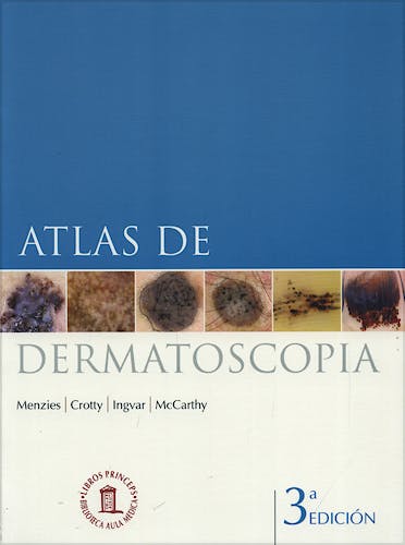 Portada del libro 9788478855131 Atlas de Dermatoscopia