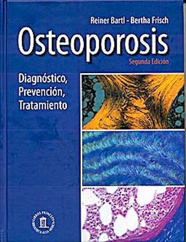 Portada del libro 9788478855179 Osteoporosis. Diagnóstico, Prevención, Tratamiento
