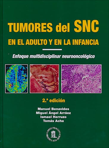 Portada del libro 9788478855391 Tumores del Sistema Nervioso Central en el Adulto y en la Infancia. Enfoque Multidisciplinar Neurooncológico