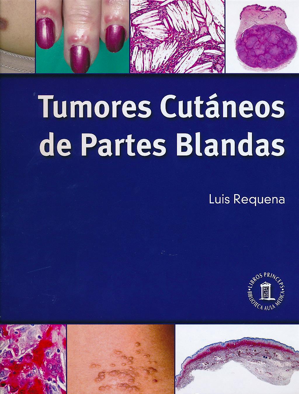 Portada del libro 9788478855537 Tumores Cutáneos de Partes Blandas (Tapa Blanda)