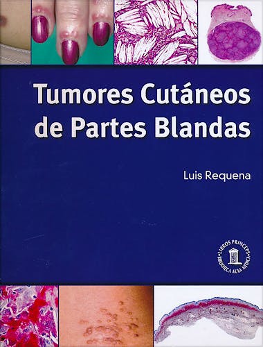 Portada del libro 9788478855537 Tumores Cutáneos de Partes Blandas (Tapa Blanda)