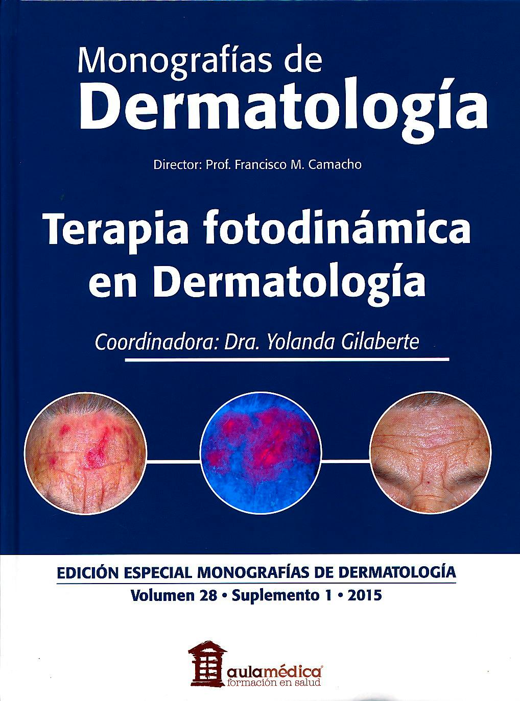 Portada del libro 9788478855834 Monografías de Dermatología, Vol. 28 Suplemento 1: Terapia Fotodinámica en Dermatología