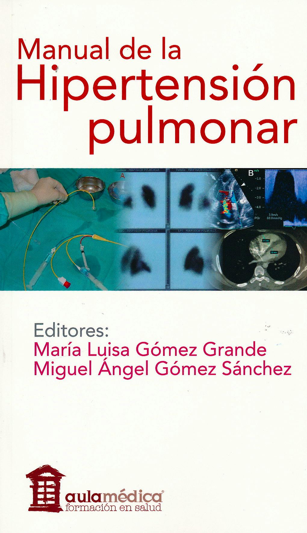 Portada del libro 9788478855865 Manual de la Hipertension Pulmonar