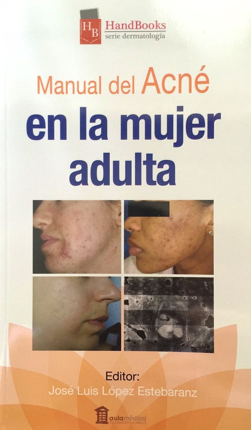 Portada del libro 9788478855926 Manual del Acné en la Mujer Adulta