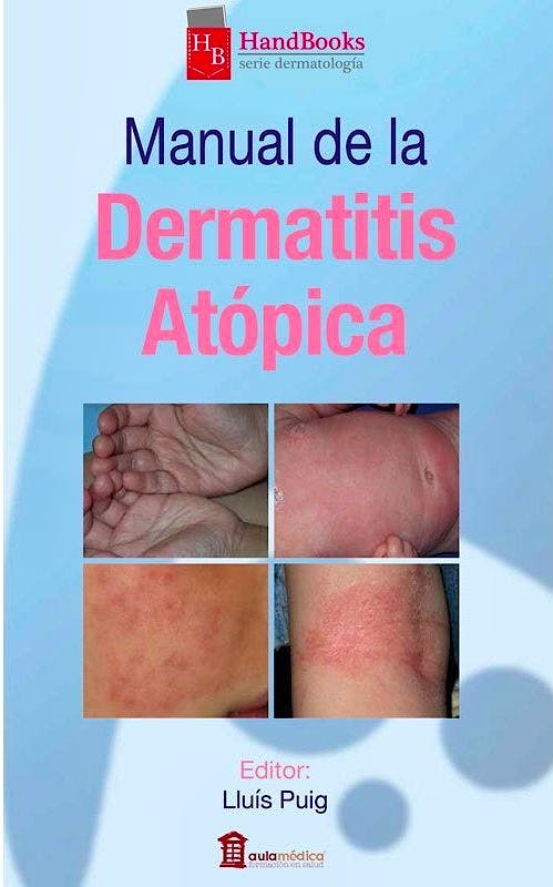 Portada del libro 9788478855988 Manual de la Dermatitis Atópica