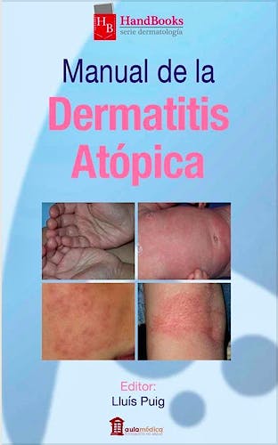 Portada del libro 9788478855988 Manual de la Dermatitis Atópica