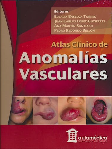 Portada del libro 9788478856091 Atlas Clínico de Anomalías Vasculares
