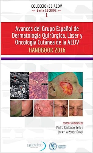 Portada del libro 9788478856114 Avances del Grupo Español de Dermatologia Quirurgica, Laser y Oncologia Cutanea de la Aedv. Handbook 2016