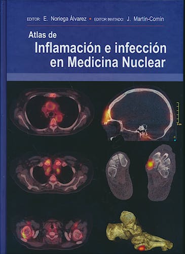 Portada del libro 9788478856183 Atlas de Inflamación e Infección en Medicina Nuclear