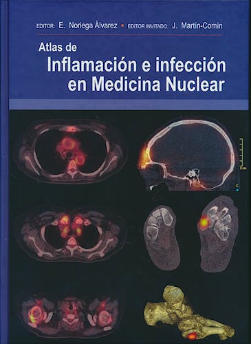 Portada del libro 9788478856183 Atlas de Inflamación e Infección en Medicina Nuclear