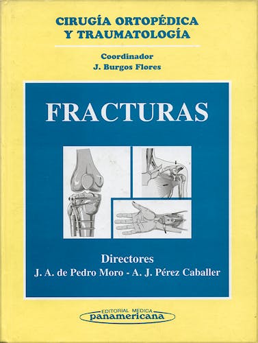 Portada del libro 9788479033446 Cirugia Ortopedica y Traumatologia: Fracturas