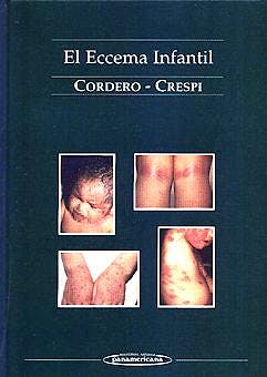 Portada del libro 9788479034344 El Eccema Infantil