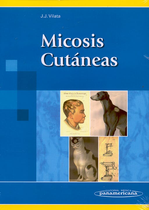 Portada del libro 9788479034849 Micosis Cutaneas