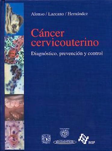 Portada del libro 9788479035617 Cancer Cervicouterino. Diagnostico, Prevencion y Control