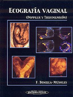 Portada del libro 9788479035662 Ecografia Vaginal. Doppler y Tridimensional