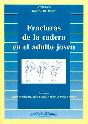 Portada del libro 9788479035969 Fracturas de la Cadera en el Adulto Joven