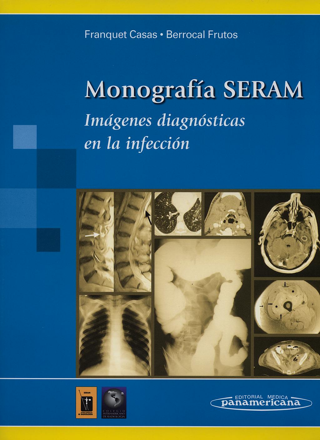 Portada del libro 9788479036010 Imágenes Diagnosticas en la Infeccion. Monografia Seram