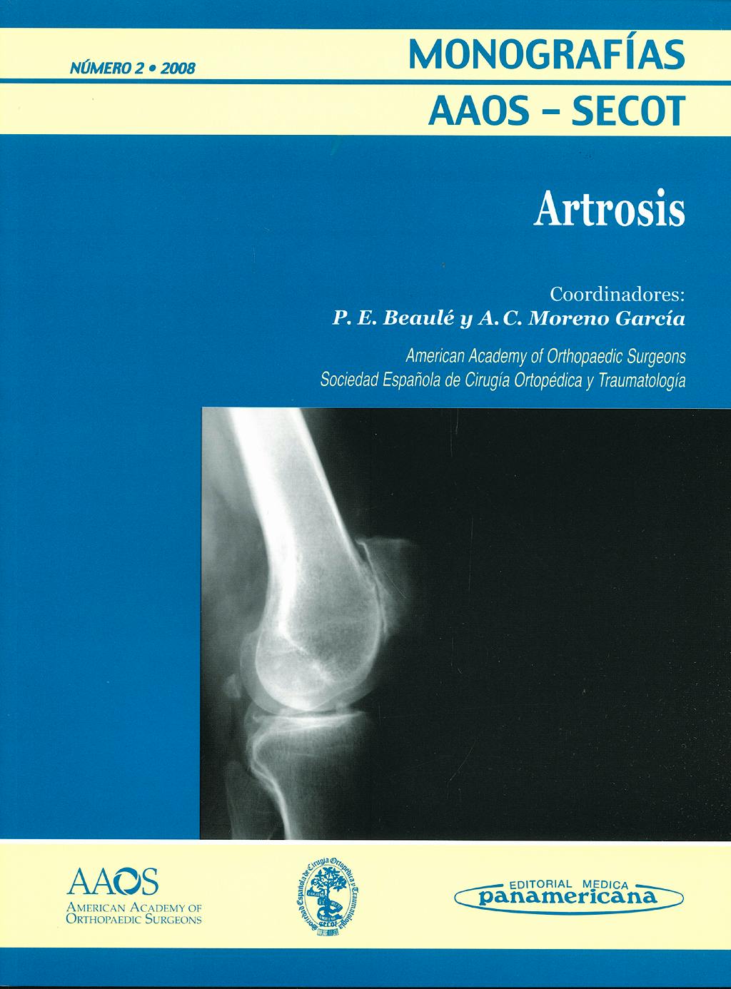 Portada del libro 9788479037451 Artrosis (Monografias Aaos-Secot Nº2 2008)