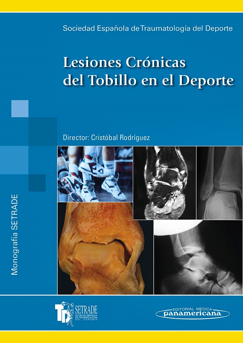 Portada del libro 9788479037925 Lesiones Crónicas del Tobillo en el Deporte