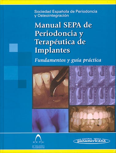 Portada del libro 9788479038793 Manual SEPA de Periodoncia y Terapéutica de Implantes. Fundamentos y Guía Práctica