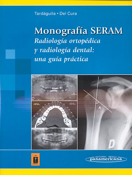 Portada del libro 9788479038977 Monografía SERAM. Radiología Ortopédica y Radiología Dental: una Guía Práctica