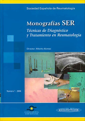 Portada del libro 9788479039042 Técnicas de Diagnóstico y Tratamiento en Reumatología. Monografías SER