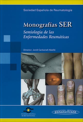 Portada del libro 9788479039073 Semiología de las Enfermedades Reumáticas. Monografías SER