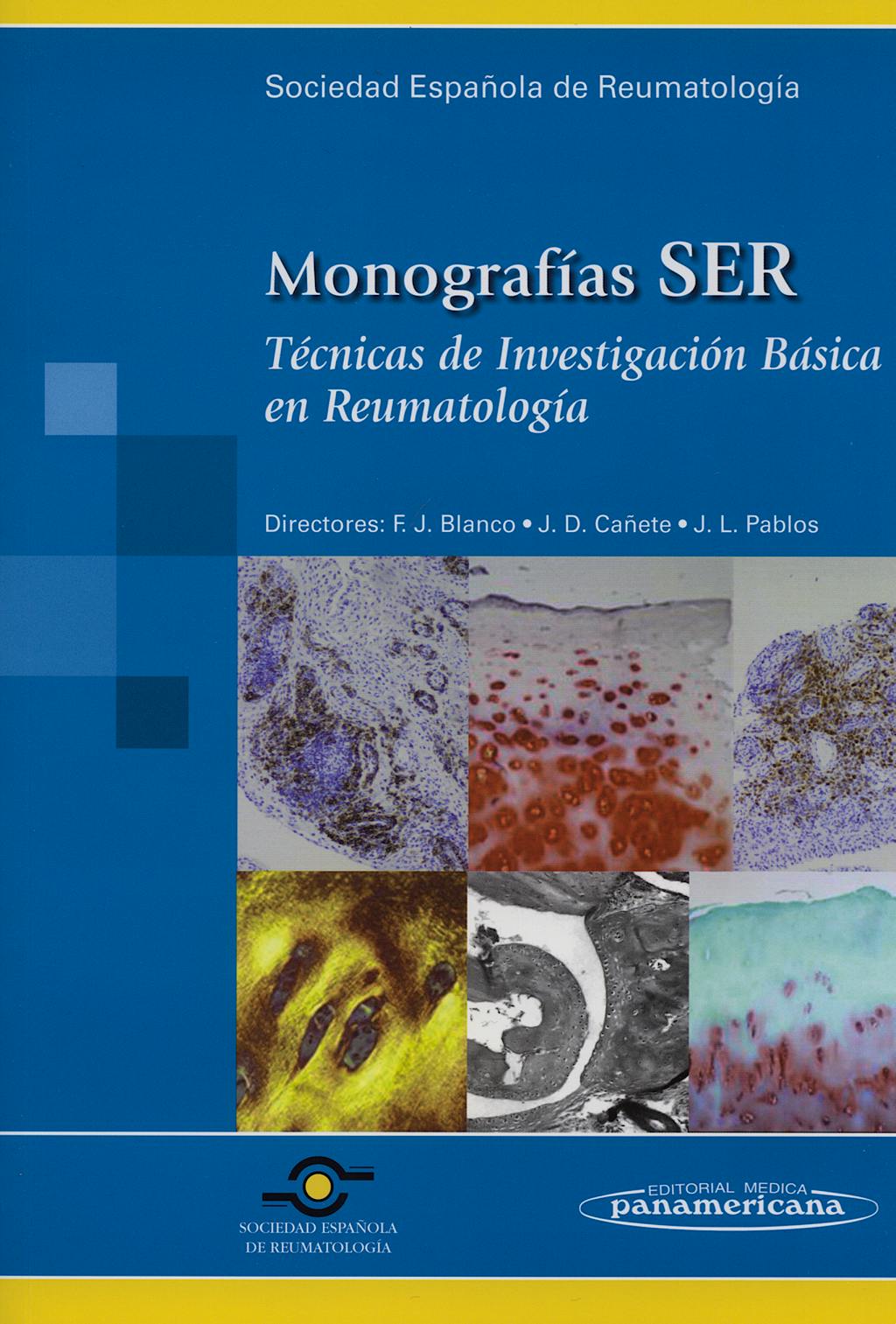 Portada del libro 9788479039080 Tecnicas de Investigacion Basica en Reumatologia. Monografias Ser