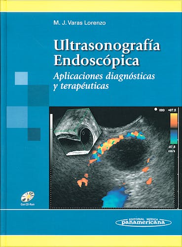 Portada del libro 9788479039868 Ultrasonografía Endoscópica. Aplicaciones Diagnósticas y Terapéuticas