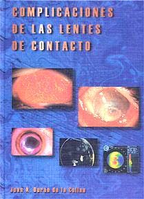 Portada del libro 9788479784010 Complicaciones de las Lentes de Contacto