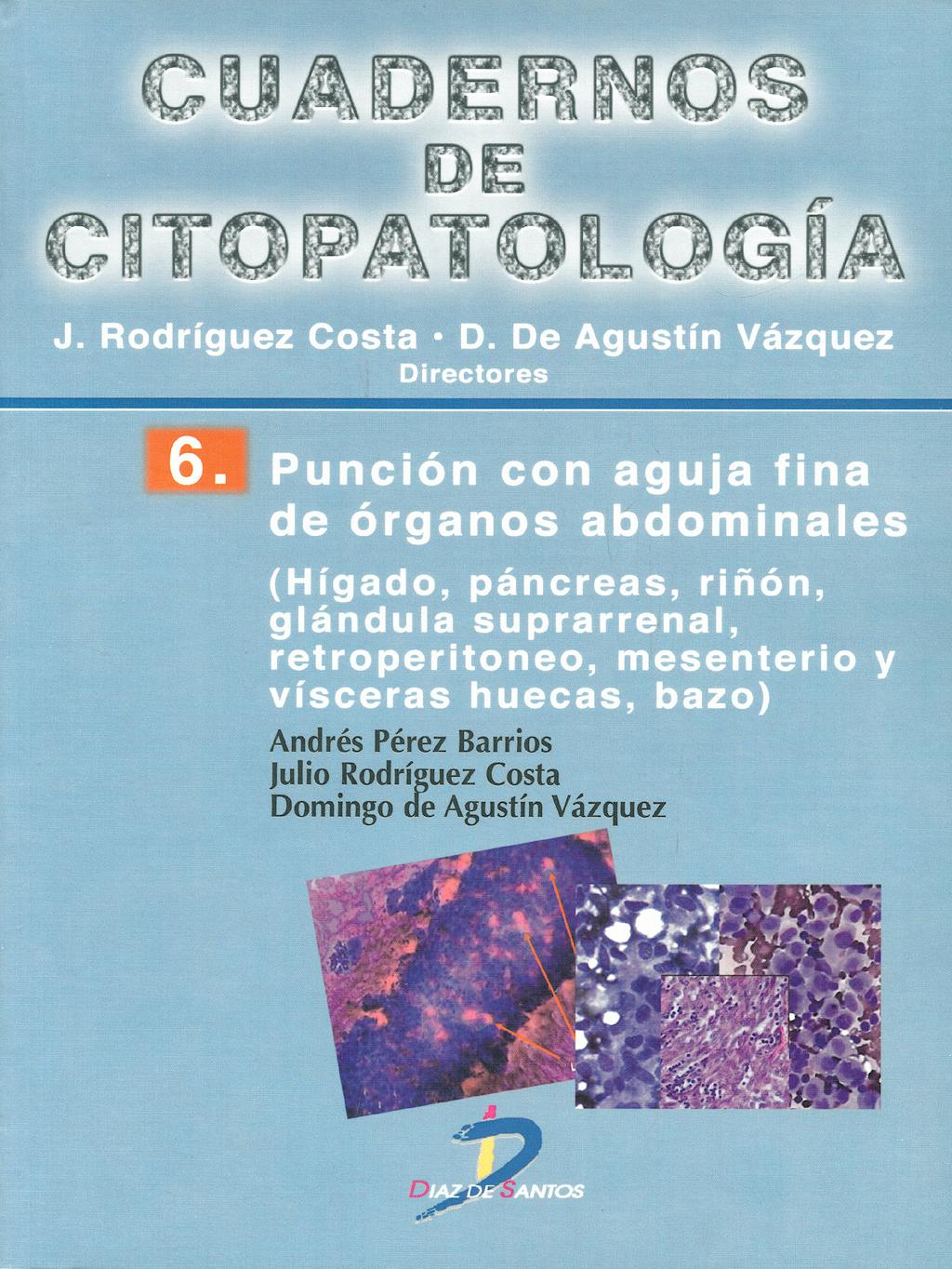 Portada del libro 9788479788803 Cuadernos de Citopatología 6: Punción con Aguja Fina de Órganos Abdominales