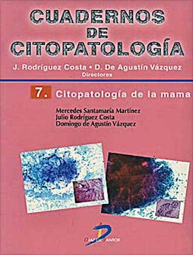 Portada del libro 9788479789633 Cuadernos de Citopatología 7: Citopatología de la Mama
