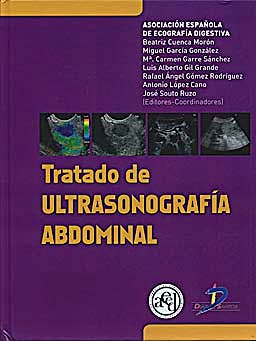 Portada del libro 9788479789732 Tratado de Ultrasonografía Abdominal