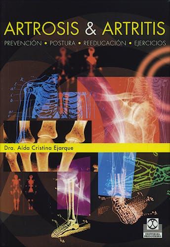 Portada del libro 9788480190404 Artrosis y Artritis. Prevencion, Postura, Reeducacion, Ejercicios