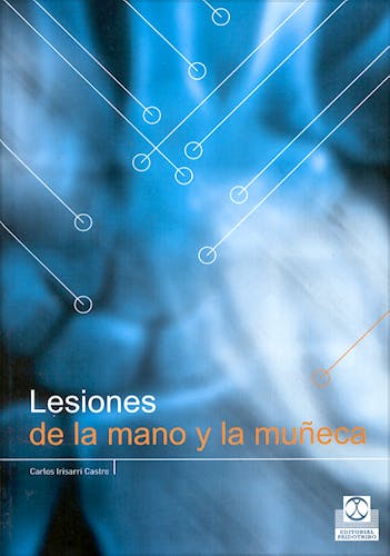 Portada del libro 9788480198233 Lesiones de la Mano y la Muñeca