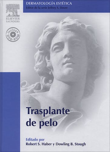 Portada del libro 9788480862004 Trasplante de Pelo (Dermatología Estética)