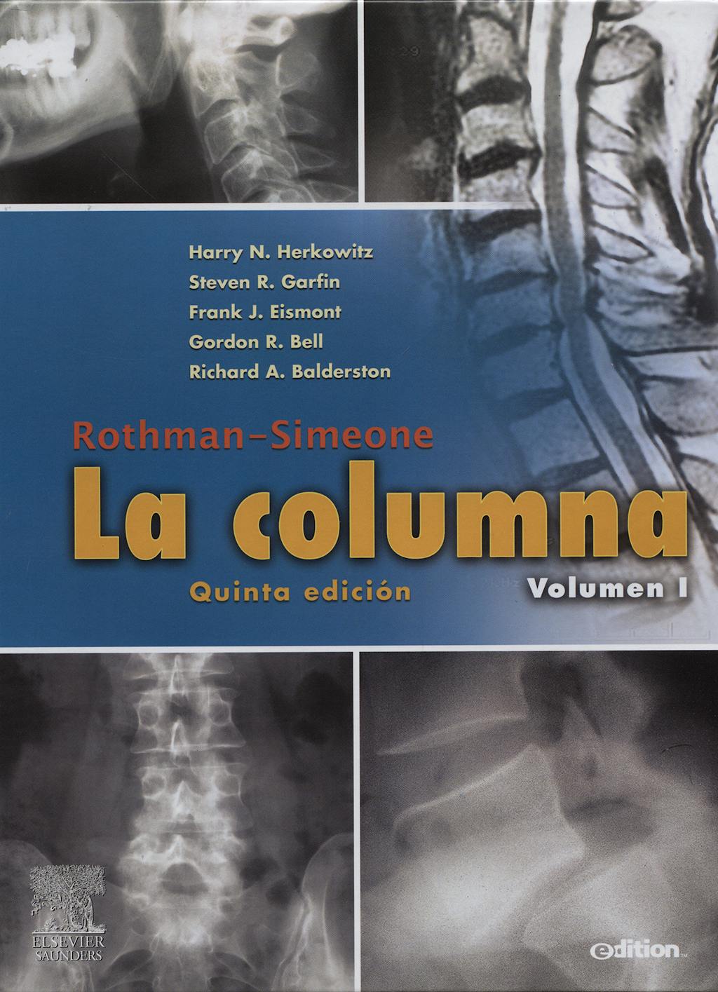 Portada del libro 9788480862370 Rothman-Simeone La Columna, 2 Vols.