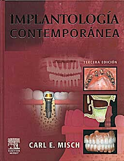 Portada del libro 9788480863841 Implantología Contemporánea