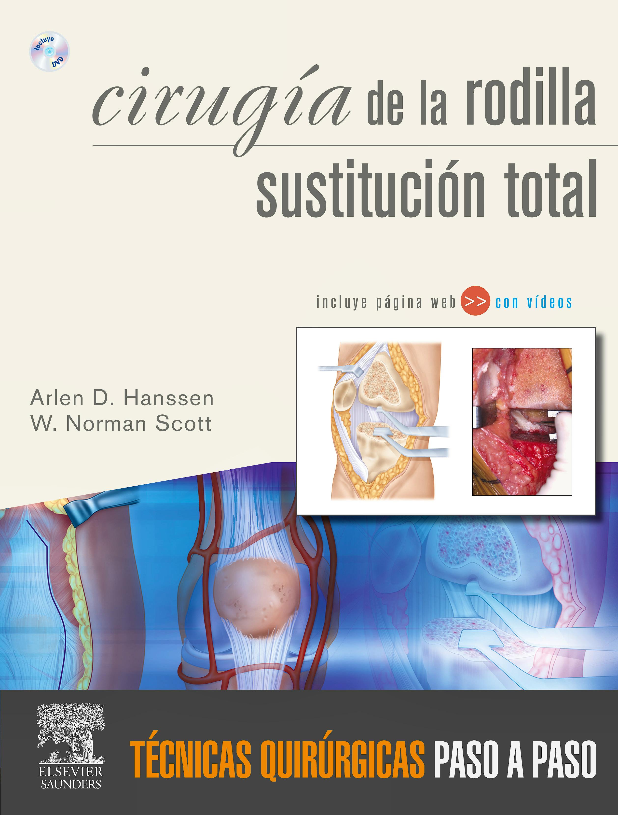 Portada del libro 9788480866613 Cirugia de la Rodilla. Sustitucion Total. Tecnicas Quirurgicas Paso a Paso + Dvd y Web (Ambos en Ingles)