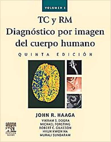 Portada del libro 9788480867245 TC y RM. Diagnóstico por Imagen del Cuerpo Humano, 2 Vols.