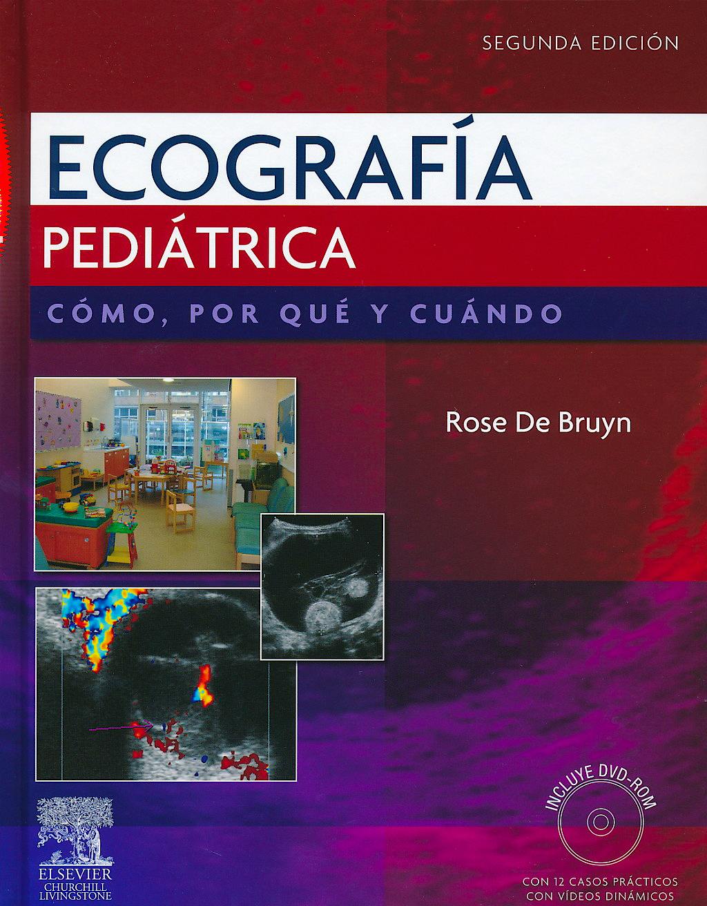 Portada del libro 9788480868815 Ecografía Pediátrica. Cómo, Por Qué y Cuándo + DVD-ROM
