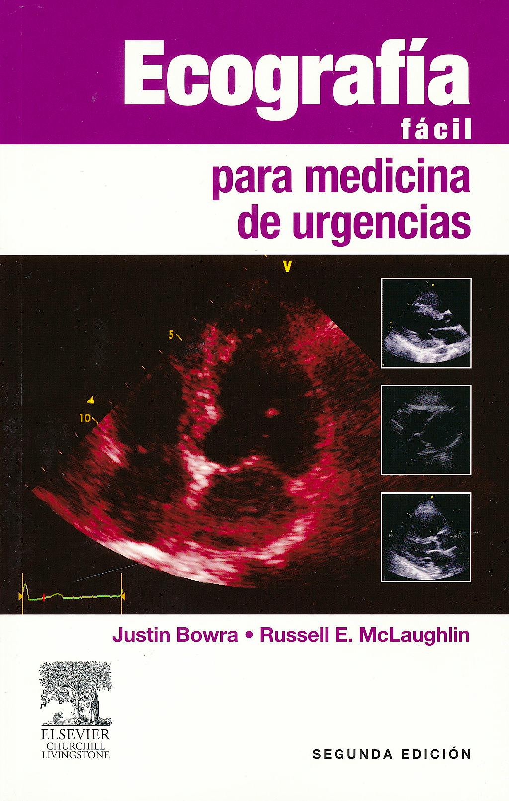 Portada del libro 9788480869553 Ecografía Fácil para Medicina de Urgencias