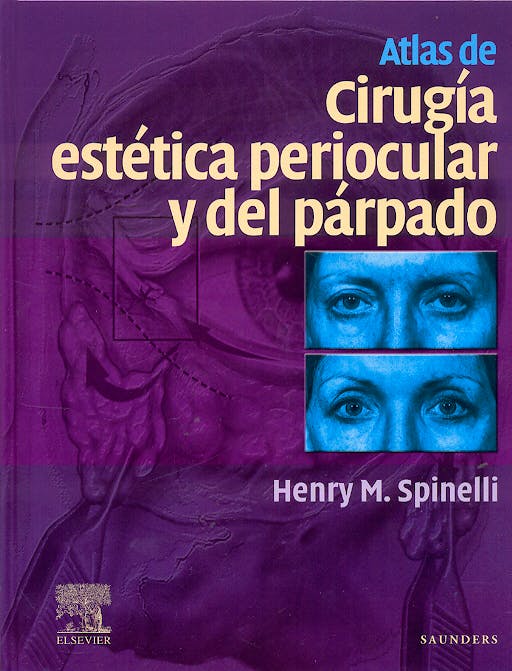 Portada del libro 9788481748352 Atlas de Cirugía Estética Periocular y del Parpado