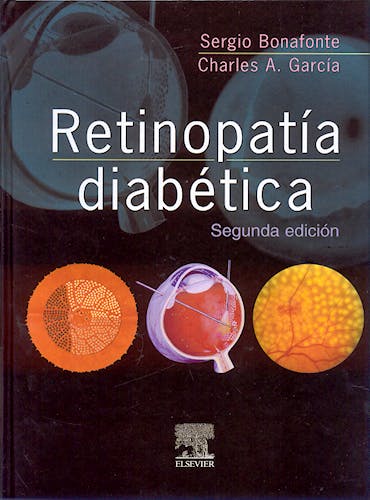 Portada del libro 9788481748512 Retinopatía Diabética
