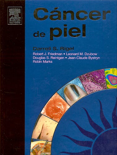 Portada del libro 9788481748758 Cáncer de Piel + CD