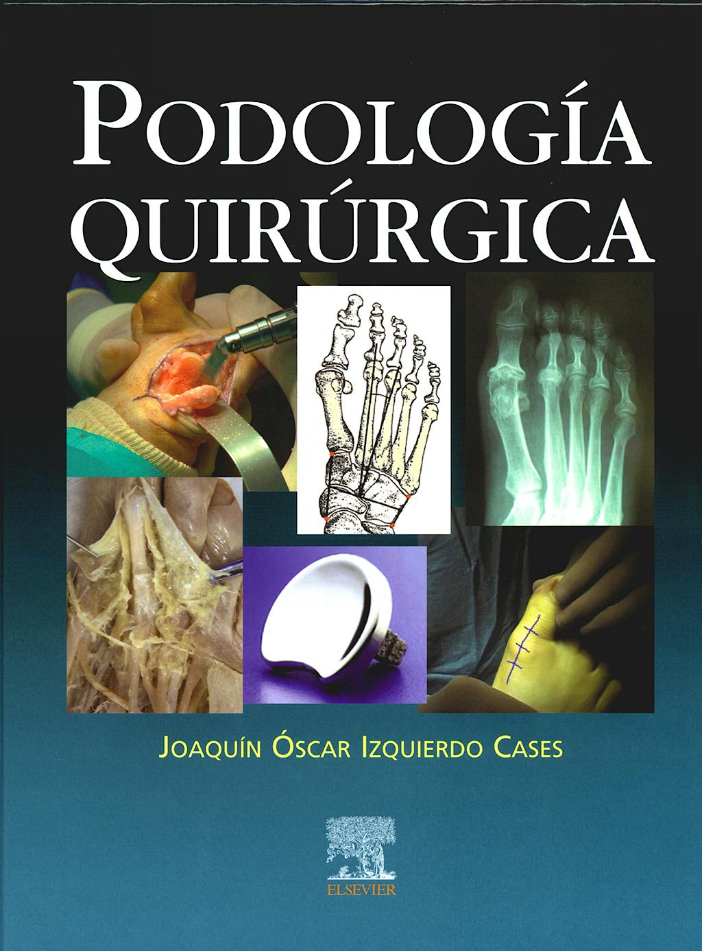 Portada del libro 9788481749151 Podología Quirúrgica