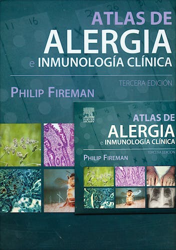 Portada del libro 9788481749434 Atlas de Alergia e Inmunologia Clinica + Cd
