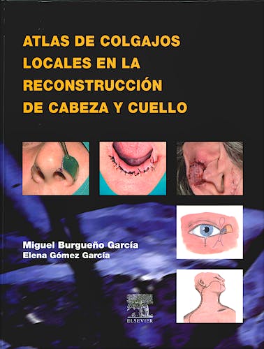 Portada del libro 9788481749625 Atlas de Colgajos Locales en la Reconstrucción de Cabeza y Cuello